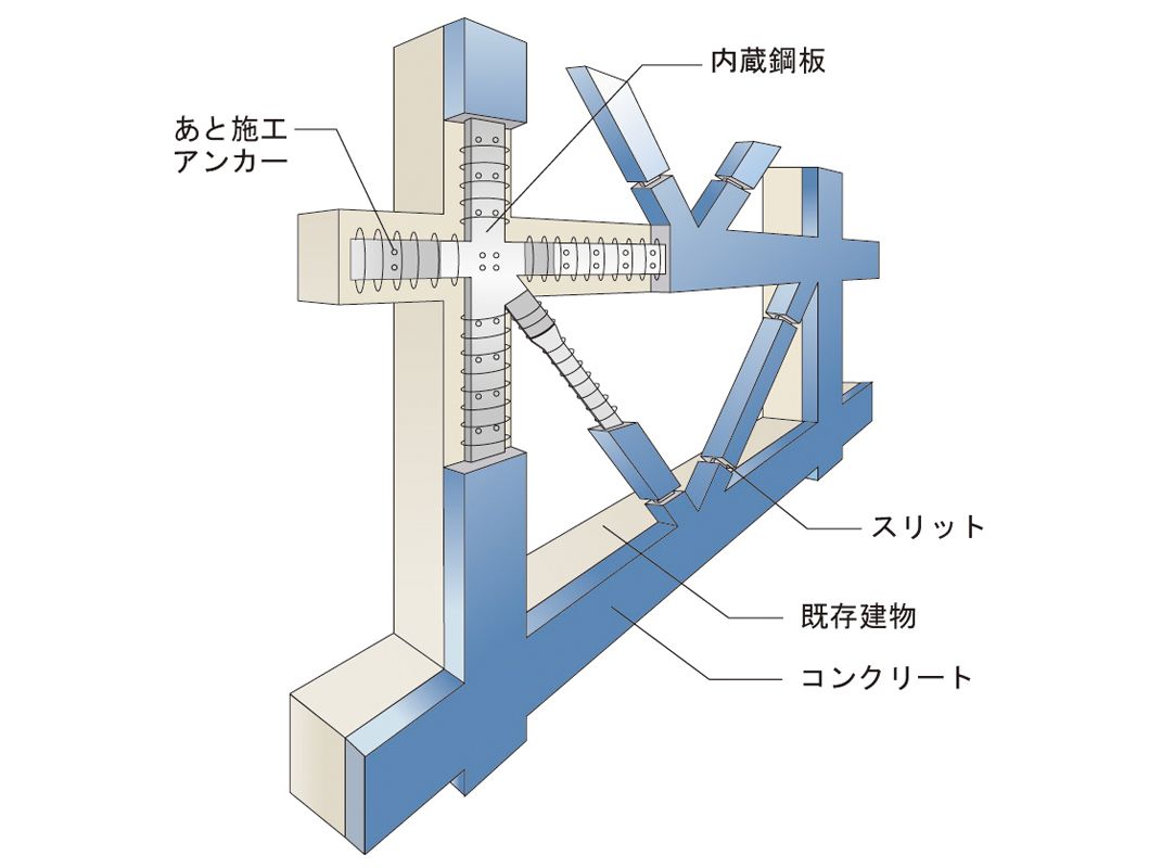 ボンドレスブレースタイプ